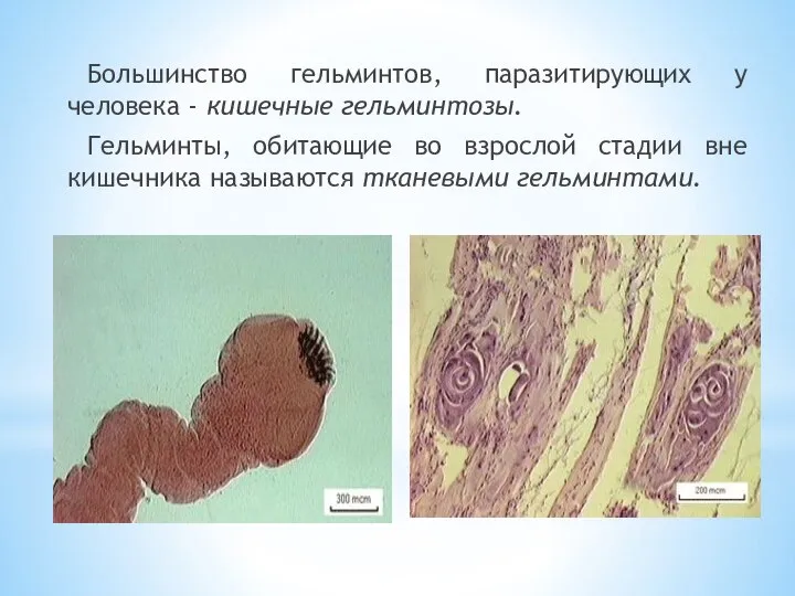 Большинство гельминтов, паразитирующих у человека - кишечные гельминтозы. Гельминты, обитающие во взрослой