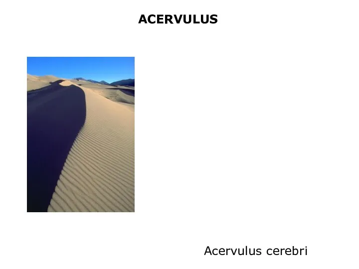 ACERVULUS Acervulus cerebri