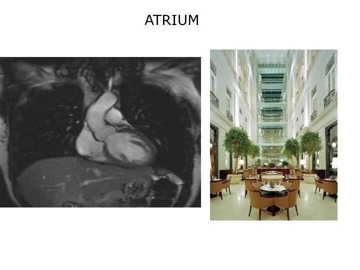 ATRIUM