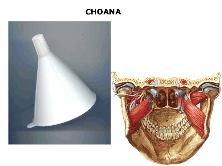 CHOANA