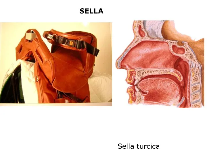 SELLA Sella turcica