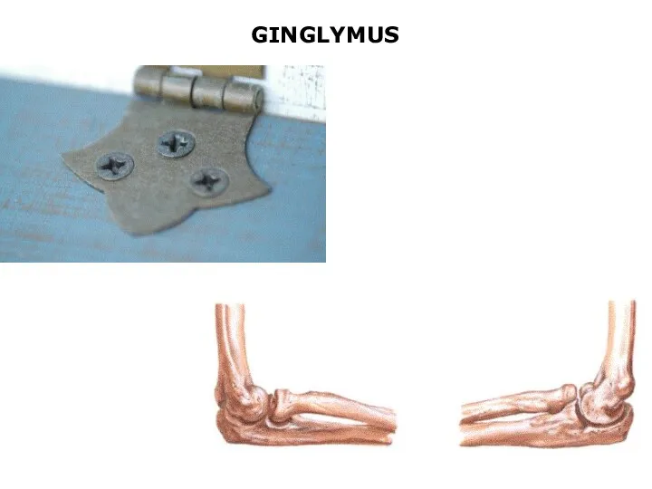 GINGLYMUS