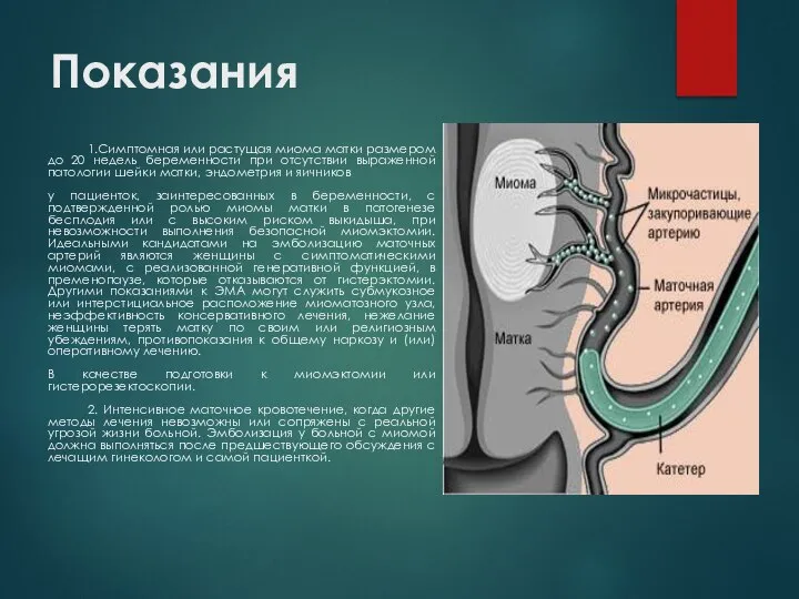 Показания 1.Симптомная или растущая миома матки размером до 20 недель беременности при