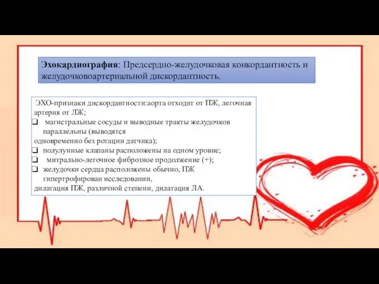 Эхокардиография: Предсердно-желудочковая конкордантность и желудочковоартериальной дискордантность. ЭХО-признаки дискордантности:аорта отходит от ПЖ, легочная