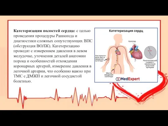 Катетеризация полостей сердца: с целью проведения процедуры Рашкинда и диагностики сложных сопутствующих