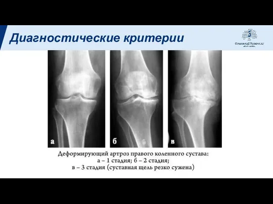 Диагностические критерии