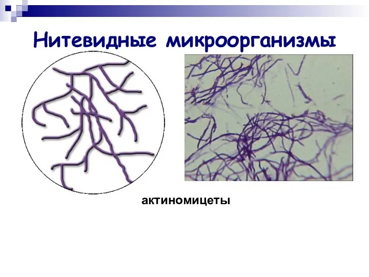 Нитевидные микроорганизмы актиномицеты