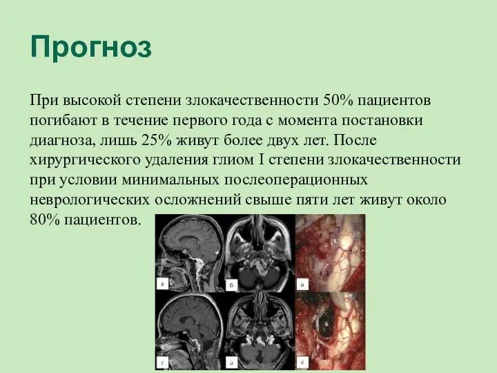 Прогноз При высокой степени злокачественности 50% пациентов погибают в течение первого года