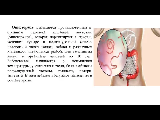 Описторхоз- вызывается проникновением в организм человека кошачьей двуустки (описторхиса), которая паразитирует в