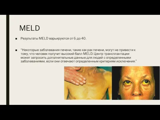 MELD Результаты MELD варьируются от 6 до 40. “Некоторые заболевания печени, такие