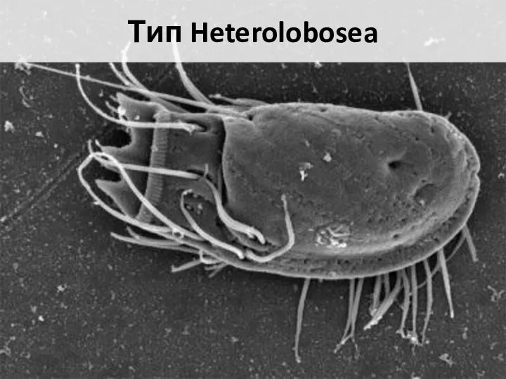 Тип Heterolobosea