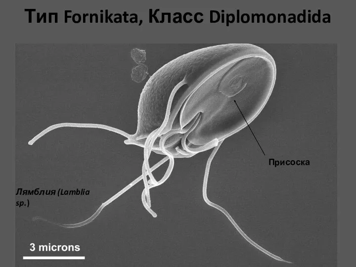 Тип Fornikata, Класс Diplomonadida Присоска Лямблия (Lamblia sp.)