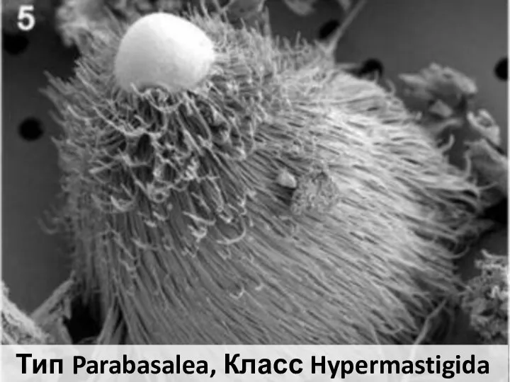 Тип Parabasalea, Класс Hypermastigida