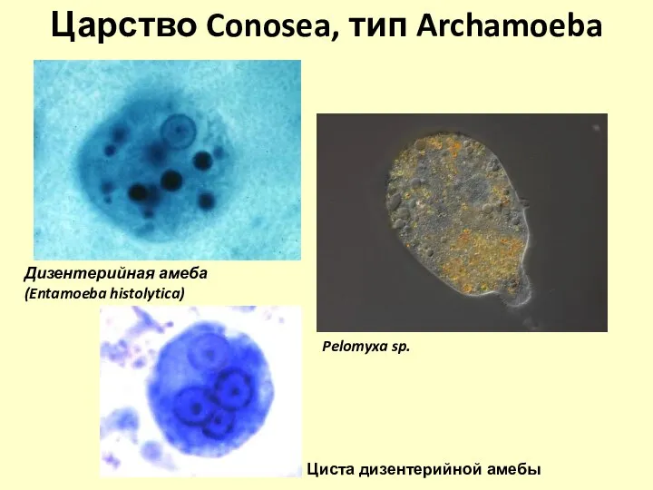 Царство Conosea, тип Archamoeba Дизентерийная амеба (Entamoeba histolytica) Циста дизентерийной амебы Pelomyxa sp.