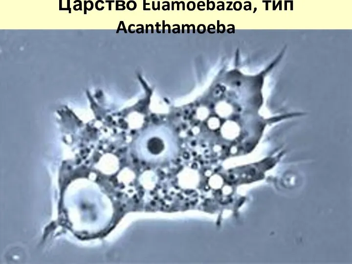 Царство Euamoebazoa, тип Acanthamoeba