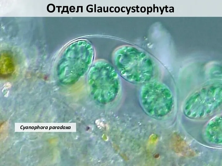 Отдел Glaucocystophyta Cyanophora paradoxa