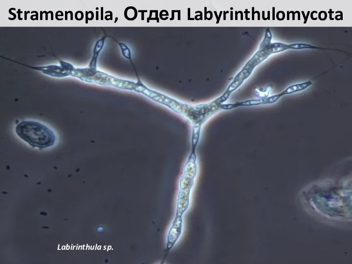 Stramenopila, Отдел Labyrinthulomycota Labirinthula sp.