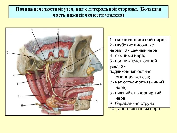 Поднижнечелюстной узел, вид с латеральной стороны. (Большая часть нижней челюсти удалена) 1