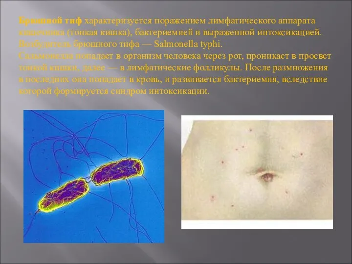 Брюшной тиф характеризуется поражением лимфатического аппарата кишечника (тонкая кишка), бактериемией и выраженной