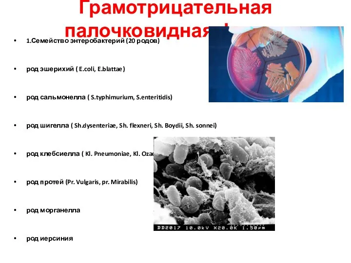 Грамотрицательная палочковидная флора: 1.Семейство энтеробактерий (20 родов) род эшерихий ( E.coli, E.blattae)