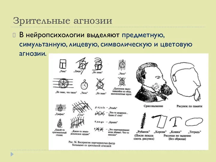 Зрительные агнозии В нейропсихологии выделяют предметную, симультанную, лицевую, символическую и цветовую агнозии.