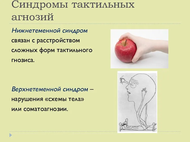 Синдромы тактильных агнозий Нижнетеменной синдром связан с расстройством сложных форм тактильного гнозиса.