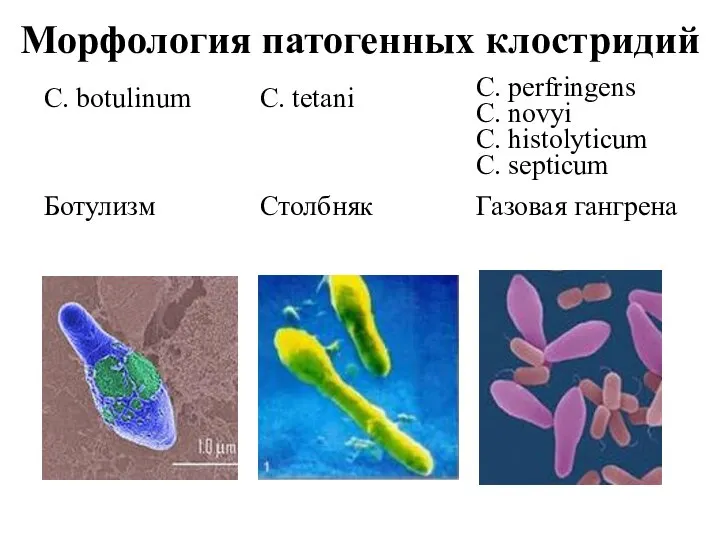 Морфология патогенных клостридий