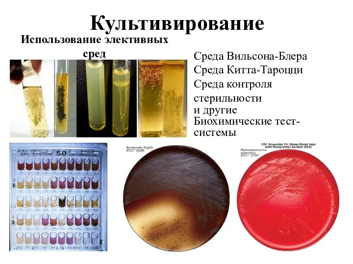 Культивирование Использование элективных сред Среда Вильсона-Блера Среда Китта-Тароцци Среда контроля стерильности и другие Биохимические тест-системы