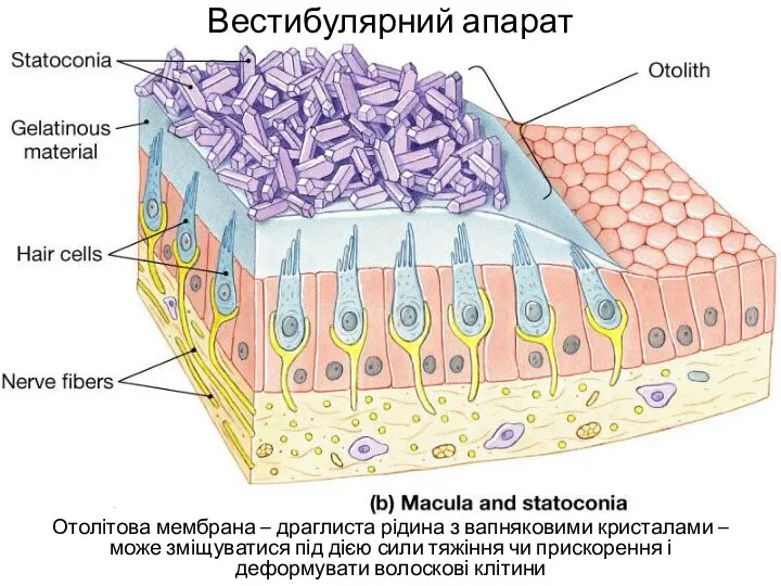 Вестибулярний апарат Отолітова мембрана – драглиста рідина з вапняковими кристалами – може