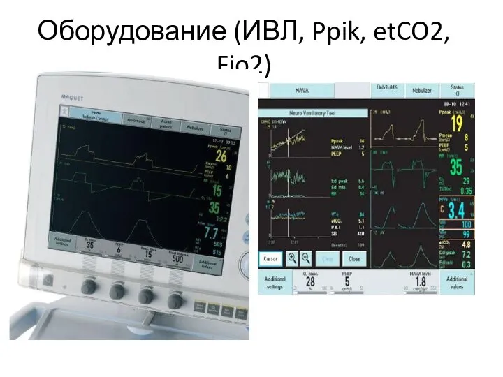 Оборудование (ИВЛ, Ppik, etCO2, Fio2)