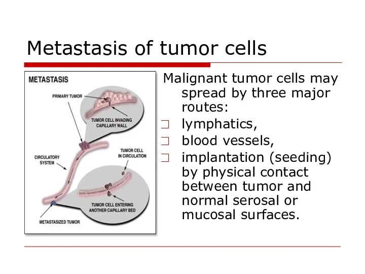 Metastasis of tumor cells Malignant tumor cells may spread by three major