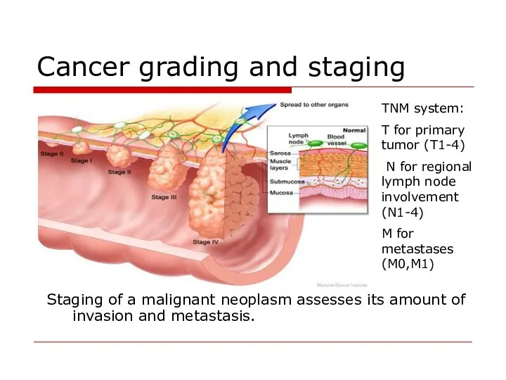 Cancer grading and staging Staging of a malignant neoplasm assesses its amount