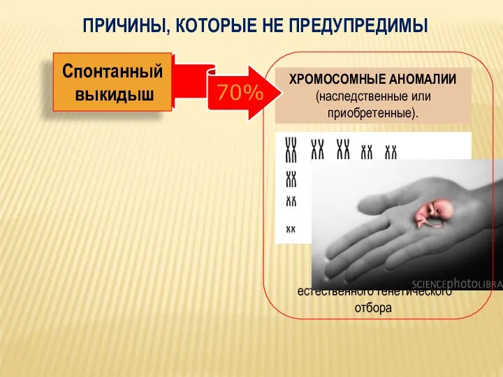 ХРОМОСОМНЫЕ АНОМАЛИИ (наследственные или приобретенные). Спонтанный выкидыш Инструмент естественного генетического отбора ПРИЧИНЫ, КОТОРЫЕ НЕ ПРЕДУПРЕДИМЫ