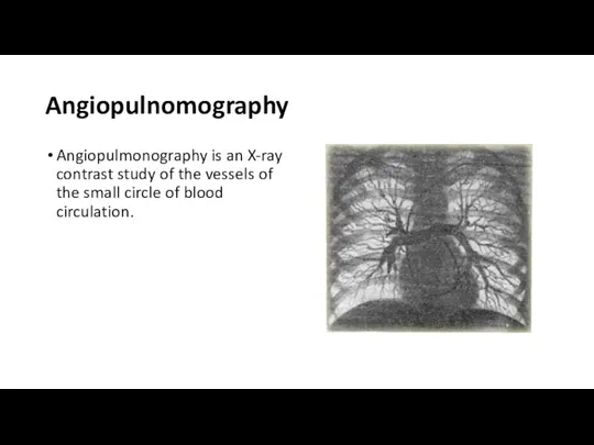 Angiopulnomography Angiopulmonography is an X-ray contrast study of the vessels of the