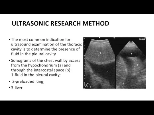 ULTRASONIC RESEARCH METHOD The most common indication for ultrasound examination of the