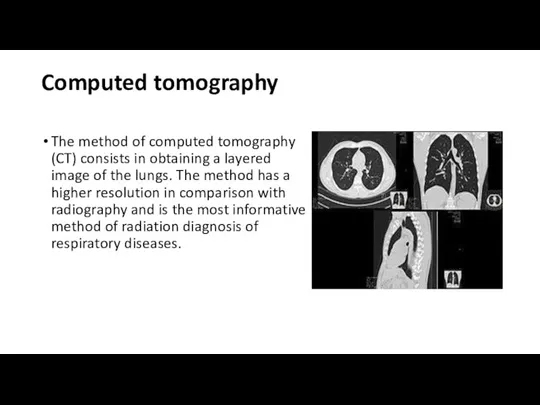 Computed tomography The method of computed tomography (CT) consists in obtaining a