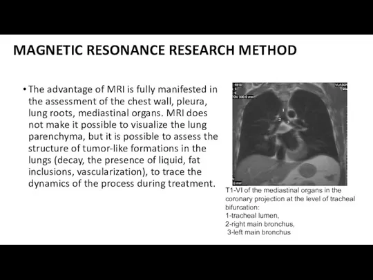 MAGNETIC RESONANCE RESEARCH METHOD The advantage of MRI is fully manifested in