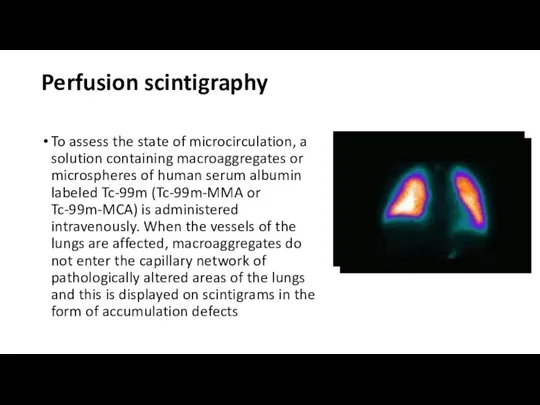 Perfusion scintigraphy To assess the state of microcirculation, a solution containing macroaggregates