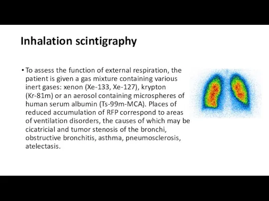 Inhalation scintigraphy To assess the function of external respiration, the patient is