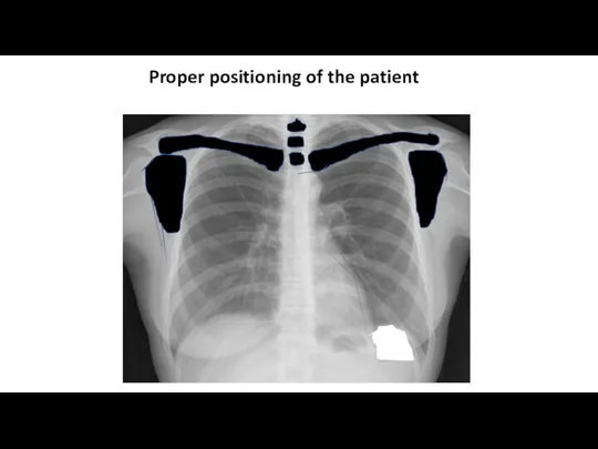Proper positioning of the patient