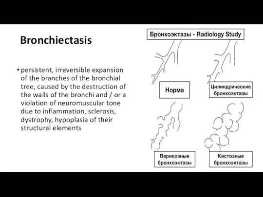 Bronchiectasis persistent, irreversible expansion of the branches of the bronchial tree, caused