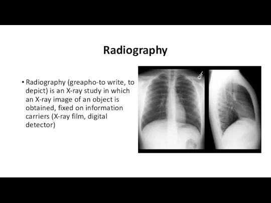 Radiography Radiography (greapho-to write, to depict) is an X-ray study in which