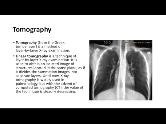 Tomography Tomography (from the Greek. tomos-layer) is a method of layer-by-layer X-ray