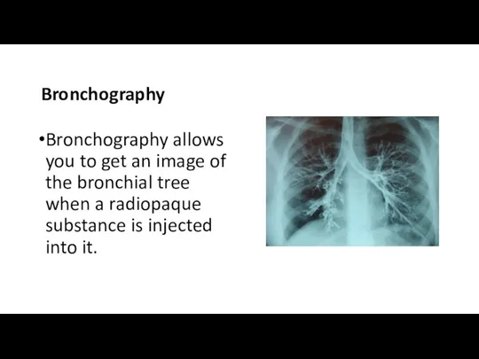 Bronchography Bronchography allows you to get an image of the bronchial tree