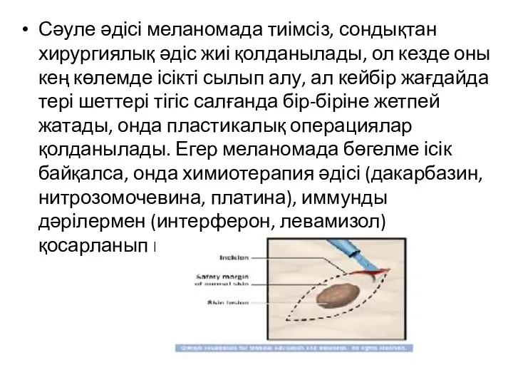 Сәуле әдісі меланомада тиімсіз, сондықтан хирургиялық әдіс жиі қолданылады, ол кезде оны