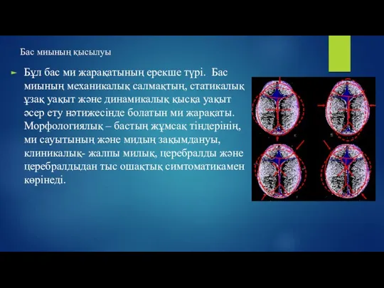 Бас миының қысылуы Бұл бас ми жарақатының ерекше түрі. Бас миының механикалық