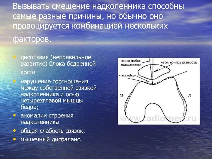 Вызывать смещение надколенника способны самые разные причины, но обычно оно провоцируется комбинацией