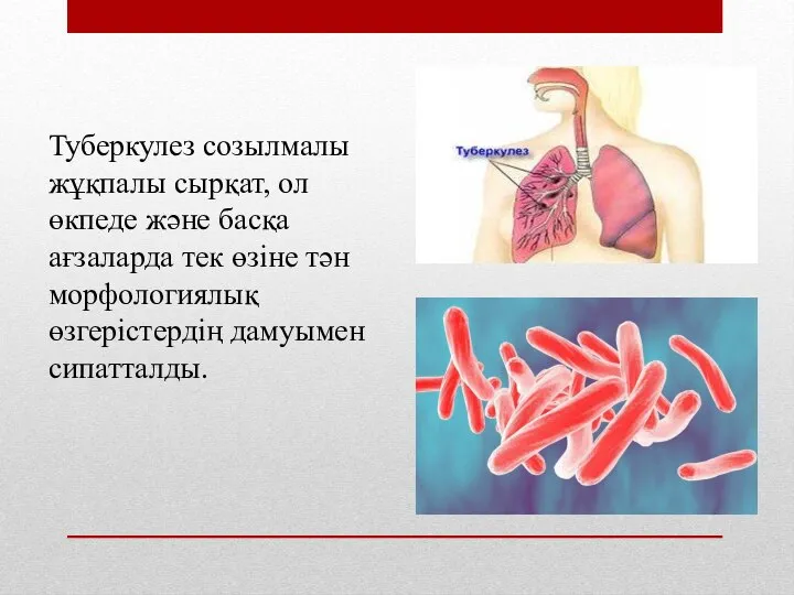 Туберкулез созылмалы жұқпалы сырқат, ол өкпеде және басқа ағзаларда тек өзіне тән морфологиялық өзгерістердің дамуымен сипатталды.