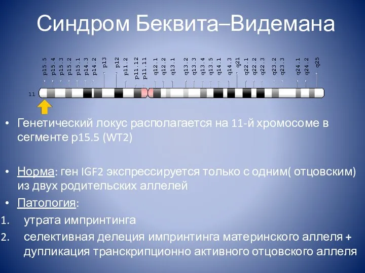 Синдром Беквита–Видемана Генетический локус располагается на 11-й хромосоме в сегменте р15.5 (WT2)