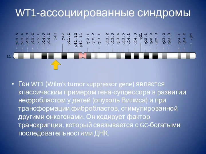 WT1-ассоциированные синдромы Ген WT1 (Wilm’s tumor suppressor gene) является классическим примером гена-супрессора